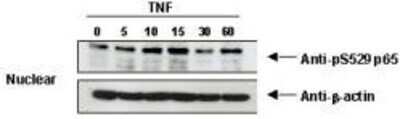 Western Blot: RelA/NFkB p65 [p Ser529] Antibody [NBP1-77808] - TNF Induces phosphorylation of p65 in KBM-5 cells. Nuclear protein lysates prepared after 0, 5, 10, 15, 30 and 60 minutes of 0.1 nM TNF treatment of KBM-5 cells shows inducible phosphorylation using phospho specific polyclonal anti-human pS529 p65. Anti-beta-actin staining confirms loading of equivalent amounts of protein. HRP conjugated Gt-anti-Rabbit IgG used to develop blot using a chemiluminescent detection method. Other detection methods will yield similar results.